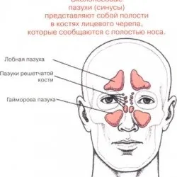 Що робити, якщо у дитини місяць минаючий нежить, все про гаймориті (минаючий) Що робити, якщо у дитини місяць минаючий нежить, все про гаймориті