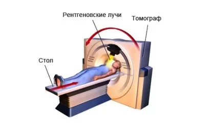Що можна виявити за допомогою комп'ютерної томографії стопи (виявити) Що можна виявити за допомогою комп'ютерної томографії стопи