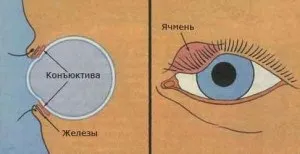 Що таке ячмінь, портал про психологію і медицину (ячмінь) Що таке ячмінь, портал про психологію і медицину