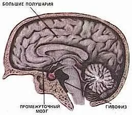 Гіпотрофія гіпофіза або синдромом порожнього турецького сідла (гіпотрофія) Гіпотрофія гіпофіза або синдромом порожнього турецького сідла