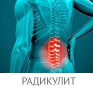 Діагностика остеохондрозу хребта шийного, поперекового, крижового відділів - диференціальна (поперекового) Діагностика остеохондрозу хребта шийного, поперекового, крижового відділів - диференціальна