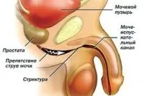 Енурез у дорослих причини, лікування (енурезу дорослих чоловіків) Енурез у дорослих причини, лікування