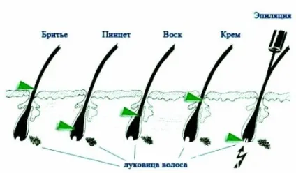 Як позбутися від волосся на тілі назавжди в домашніх умовах дівчині - 100% способи (горіхів) Як позбутися від волосся на тілі назавжди в домашніх умовах дівчині - 100% способи