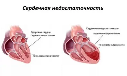 Як можна захворіти на туберкульоз ризик зараження і шляхи відкритою і закопаної формою, джерела, (можна) Як можна захворіти на туберкульоз ризик зараження і шляхи відкритою і закопаної формою, джерела,