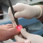 Як визначити грибок на ногах ознаки, симптоми, профілактика, все про ногах (грибок) Як визначити грибок на ногах ознаки, симптоми, профілактика, все про ногах