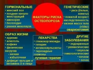 Як запобігти розвитку остеопорозу як зупинити і уникнути (зупинити) Як запобігти розвитку остеопорозу як зупинити і уникнути