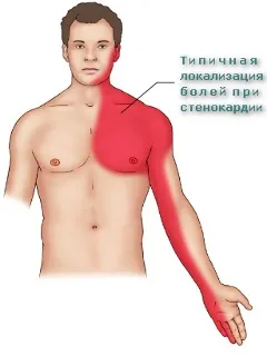 Як перевірити судини серця