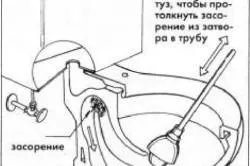 Як прибрати камінь в унітазі методи видалення і профілактика (унітазі) Як прибрати камінь в унітазі методи видалення і профілактика