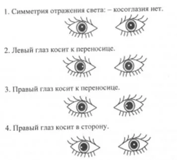Як дізнатися, чи є у вашої дитини косоокість, контент-платформа
