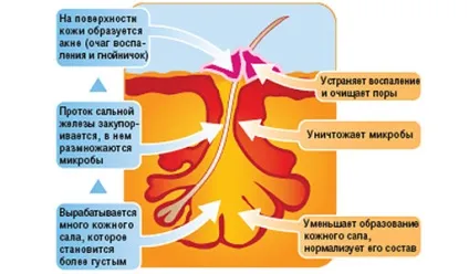 Кому потрібен крем для обличчя з азелаїнової кислотою