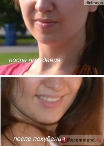 Контурна пластика скул - «дуже ефективна яет відразу кілька інших (відразу) Контурна пластика скул - «дуже ефективна яет відразу кілька інших