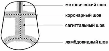 Краніосиностоз причини, види, симптоми, лікування (краніосиностозу) Краніосиностоз причини, види, симптоми, лікування