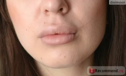 Контурна пластика скул - «дуже ефективна яет відразу кілька інших (скул) Контурна пластика скул - «дуже ефективна яет відразу кілька інших