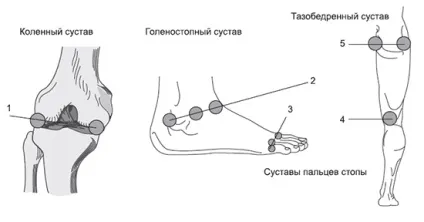 Лазерна терапія при захворюваннях суглобів - методики і схеми лікування, результати лазеротерапії (лазерне лікування п'яткової шпори) Лазерна терапія при захворюваннях суглобів - методики і схеми лікування, результати лазеротерапії