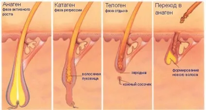 Лазерна епіляція підготовка до процедури, види, фото