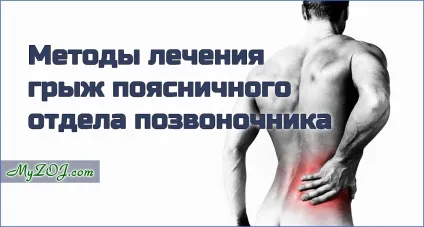 Лікування грижі поперекового відділу хребта (лікування) Лікування грижі поперекового відділу хребта
