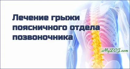 Лікування грижі поперекового відділу хребта (лікування) Лікування грижі поперекового відділу хребта