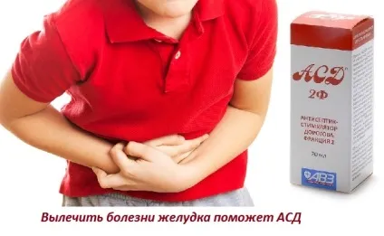 Лікування шлунка фракцією АСД 2 при виразці, гастриті, поліпах (виразці) Лікування шлунка фракцією АСД 2 при виразці, гастриті, поліпах