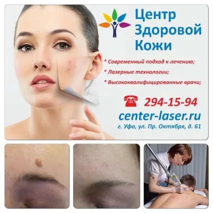 Лазерне видалення новоутворень, центр здорової шкіри (здорової) Лазерне видалення новоутворень, центр здорової шкіри