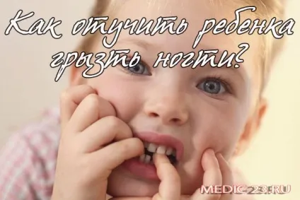 Чому дитина гризе нігті що робити батькам у даній ситуації допомога психолога (гризе) Чому дитина гризе нігті що робити батькам у даній ситуації допомога психолога
