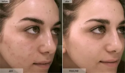 Масло какао для обличчя відгуки косметологів про застосування маски для шкіри (обличчя) Масло какао для обличчя відгуки косметологів про застосування маски для шкіри