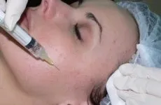 Мезороллер і засоби для нього (домашніх умовах Мезороллери) Мезороллер і засоби для нього