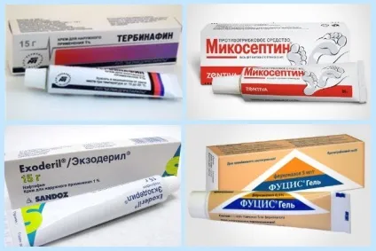 Мікотіческая екзема грибкова мікозних на руках, лікування маззю (грибкова) Мікотіческая екзема грибкова мікозних на руках, лікування маззю
