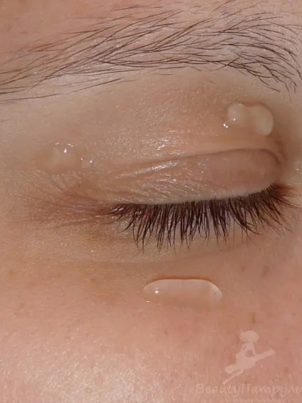 Мій відгук про гелі для шкіри навколо очей lumene purity dew drops hydrating eye gel (гелі) Мій відгук про гелі для шкіри навколо очей lumene purity dew drops hydrating eye gel