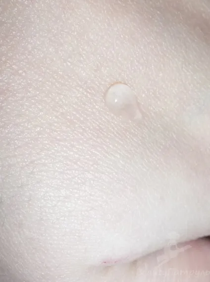 Мій відгук про гелі для шкіри навколо очей lumene purity dew drops hydrating eye gel (навколо) Мій відгук про гелі для шкіри навколо очей lumene purity dew drops hydrating eye gel