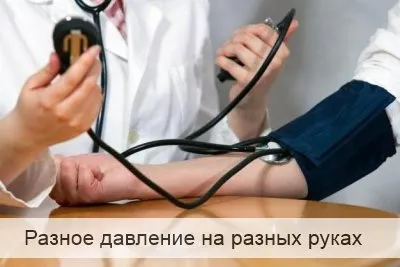 На різних руках різний артеріальний тиск (медицина) На різних руках різний артеріальний тиск