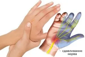 Німіють руки, особливо по ночах причина, чому і що робити (причина) Німіють руки, особливо по ночах причина, чому і що робити