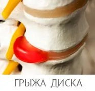 Пухлина при артрозі, чому опухають ноги, як зняти припухлості у людей похилого віку (артрозі) Пухлина при артрозі, чому опухають ноги, як зняти припухлості у людей похилого віку