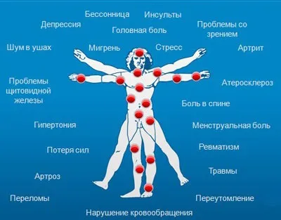 Ортопедична подушка з магнітами - користь і шкода (магнітами) Ортопедична подушка з магнітами - користь і шкода