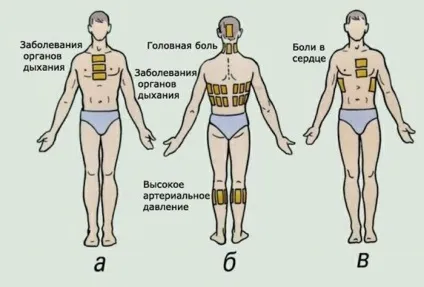 Опік від гірчичника що робити в різних ситуаціях (опік шкіри голови) Опік від гірчичника що робити в різних ситуаціях