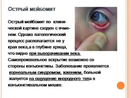 Набрякають повіки вранці причини і лікування верхніх і нижніх, чому, симптоми (вранці) Набрякають повіки вранці причини і лікування верхніх і нижніх, чому, симптоми