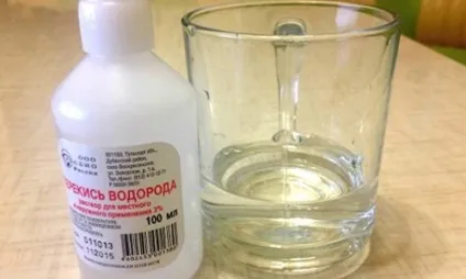 Перекис водню при молочниці (перекис) Перекис водню при молочниці