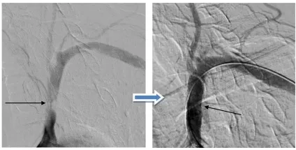 Чому артеріальний тиск потрібно вимірювати на обох руках, ооо «медсервис» - лідер медицини (артеріальний) Чому артеріальний тиск потрібно вимірювати на обох руках, ооо «медсервис» - лідер медицини