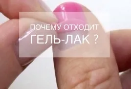 Чому відходить гель-лак і як продовжити терміни шкарпетки (чому) Чому відходить гель-лак і як продовжити терміни шкарпетки