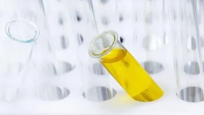 Підковоподібна нирка лікування у дитини і дорослого, узд обстеження