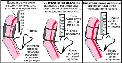 Знижений тиск що робити, які прийняти таблетки