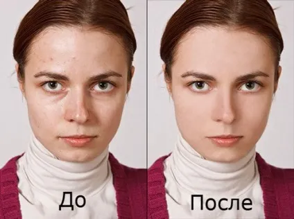 Поверхневий хімічний пілінг обличчя відгуки, фото до і після