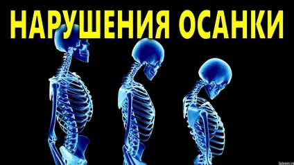 Ознаки правильної постави визначаємо красиву фігуру не виходячи з дому (красиву) Ознаки правильної постави визначаємо красиву фігуру не виходячи з дому