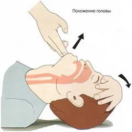Реанімація в домашніх умовах перша долікарська допомога при серцево-легеневої реанімації будинку (домашніх) Реанімація в домашніх умовах перша долікарська допомога при серцево-легеневої реанімації будинку