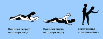 Реабілітація після ендопротезування кульшового суглоба (реабілітація після ендопротезування кульшового суглоба) Реабілітація після ендопротезування кульшового суглоба