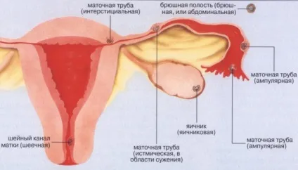 Шеечная вагітність симптоми і лікування (вагітність) Шеечная вагітність симптоми і лікування