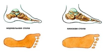 Сильно болять ноги, що робити