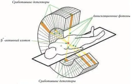 Томографія в медицині