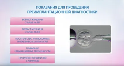 Узі на коломенської в клініці «я здорова! », Вартість узі яєчників, плода (плоду) Узі на коломенської в клініці «я здорова! », Вартість узі яєчників, плода