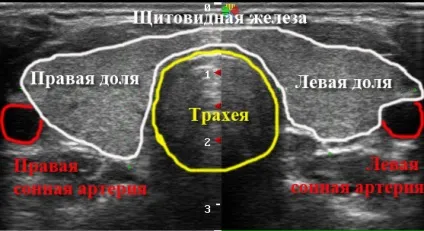 Узі щитовидної залози норми і патології (щитовидної) Узі щитовидної залози норми і патології