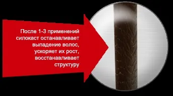 Випадання волосся